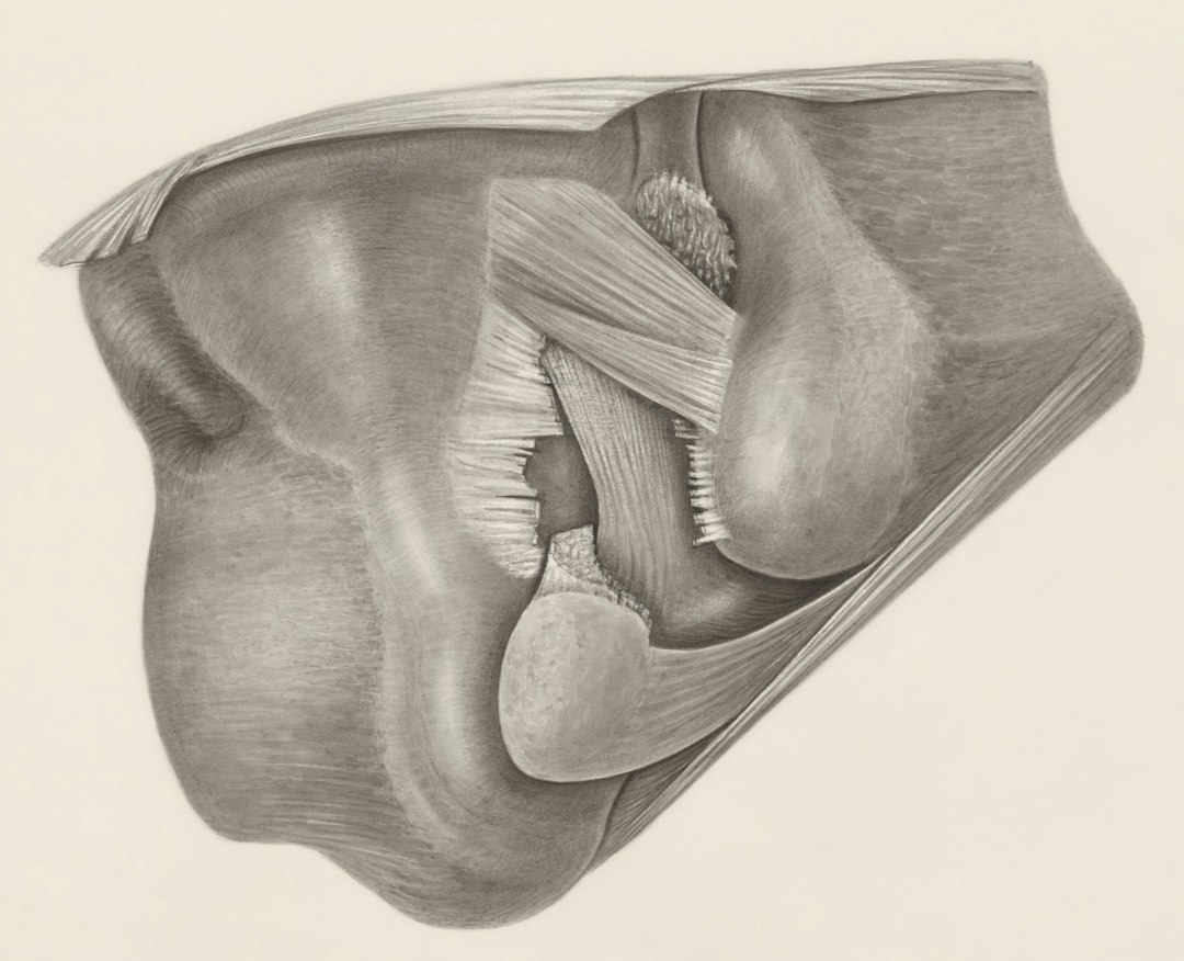 How Piriformis Syndrome Causes Leg Pain (And Why It's Often Misdiagnosed)